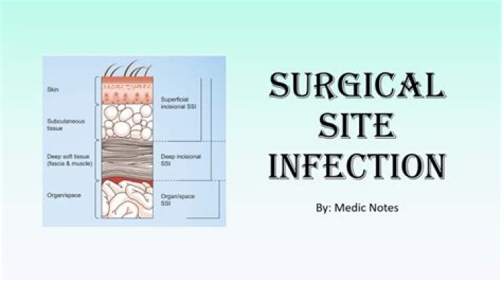 Can I get SSI at age 49?