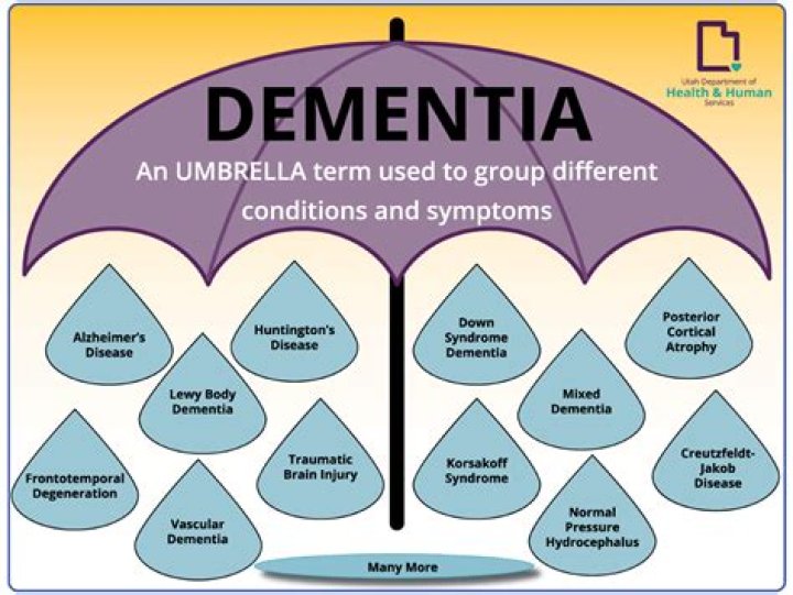 Does early retirement lead to dementia?