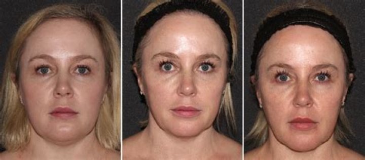 How do I fix my 2017 tax return?