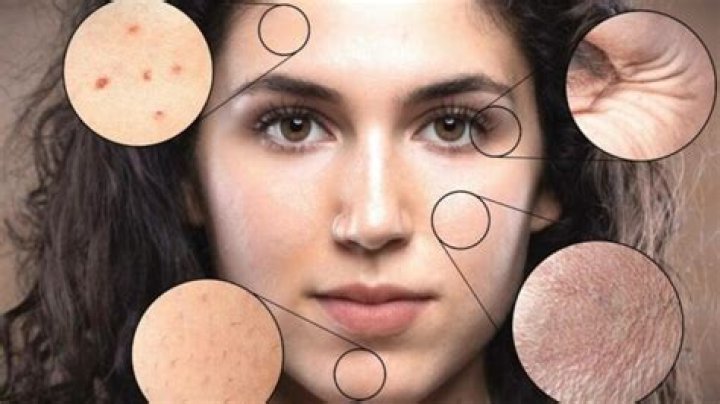 What are the 10 most common skin disorders?