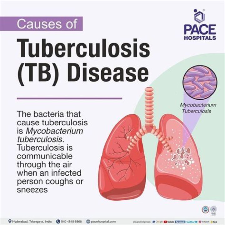 What happens if TB comes back?