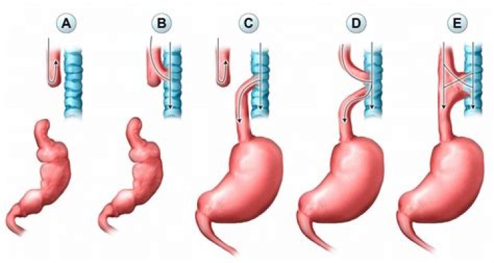 What is an EA with the IRS?
