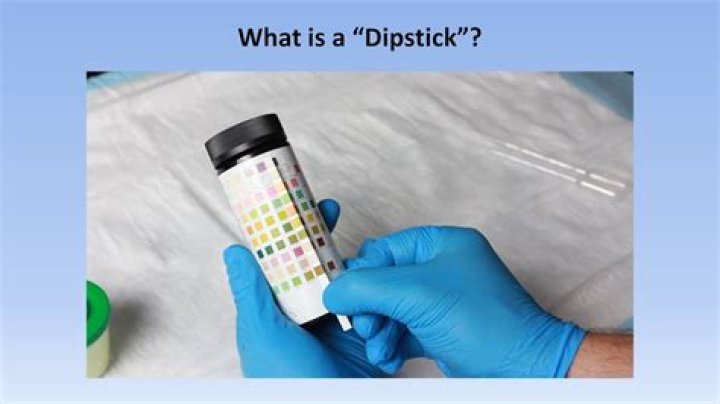 What is dip test?