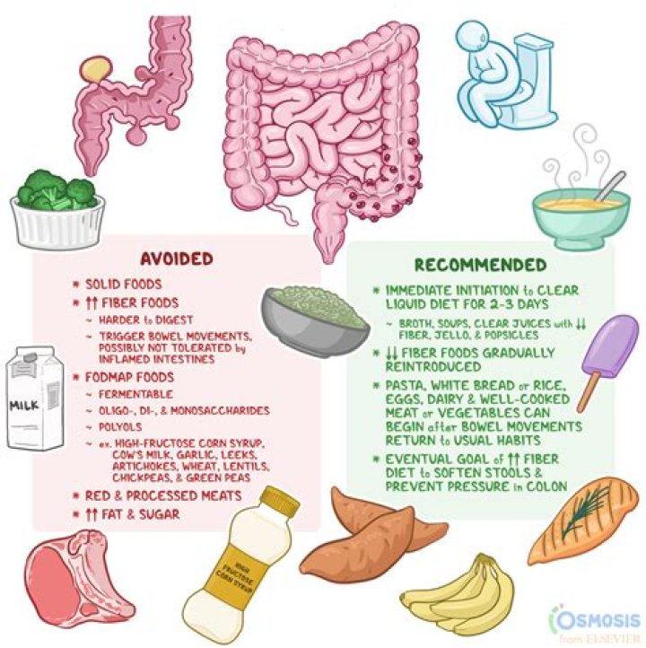 What is the correct diet for diverticulitis?