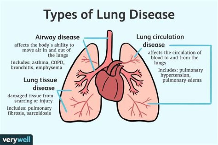 What is the rarest lung disease?
