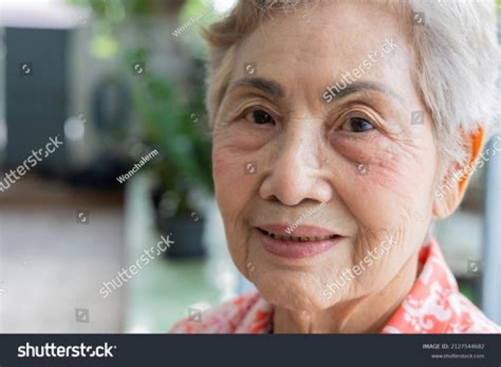 Who is the 80 year old woman in MN?